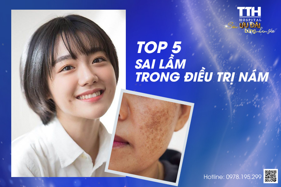 Top 5 sai lầm cần tránh trong điều trị nám